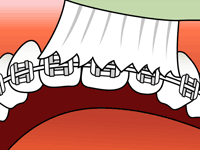 Step 1