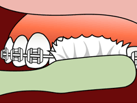 Step 1